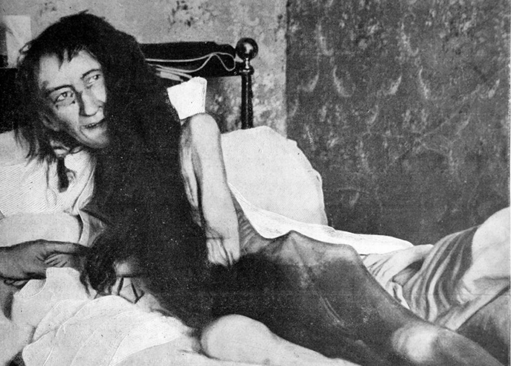 Locked Away for 25 Years: The Story of Blanche Monnier - Fabled 